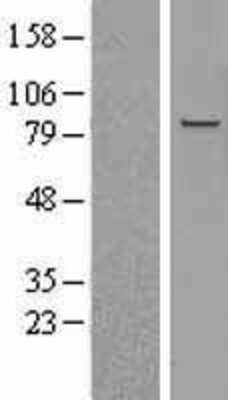 Western Blot: ERK3/MAPK6 Overexpression Lysate [NBL1-12878]