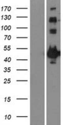 Western Blot: MAPKAPK2 Overexpression Lysate [NBP2-10538]