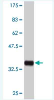 Western Blot: MAPKAP Kinase 3 Antibody (1C3) [H00007867-M04]