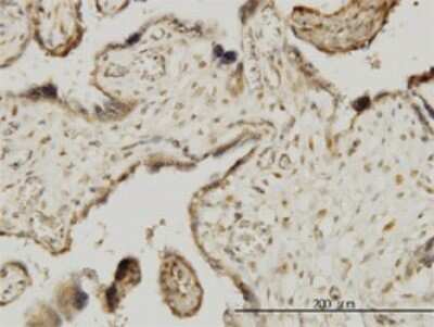 Immunohistochemistry-Paraffin: MAPKAP Kinase 3 Antibody (2B5) [H00007867-M02]