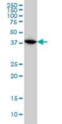 Western Blot: MAPKAP Kinase 3 Antibody (2B5) [H00007867-M02]