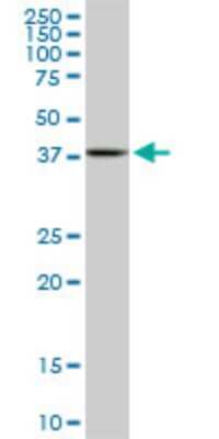 Western Blot: MAPKAP Kinase 3 Antibody (2B5) [H00007867-M02]