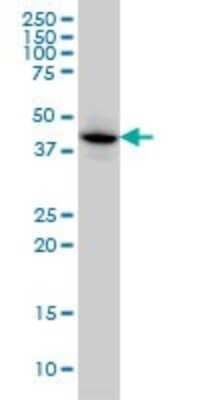 Western Blot: MAPKAP Kinase 3 Antibody (3F4) [H00007867-M01]