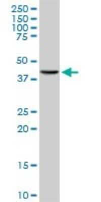 Western Blot: MAPKAP Kinase 3 Antibody (3F4) [H00007867-M01]