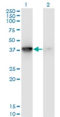 Western Blot: MAPKAP Kinase 3 Antibody (3F4) [H00007867-M01]