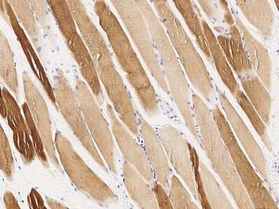 Immunohistochemistry-Paraffin: MAPKAP Kinase 3 Antibody [NBP2-99449]