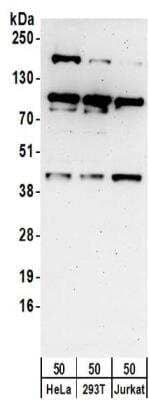 Western Blot: MAPKAP Kinase 3 Antibody [NBP2-32092]