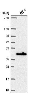 Western Blot: MAPKAP Kinase 3 Antibody [NBP2-58080]