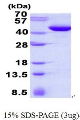 SDS-PAGE: Recombinant Human MAPKAP Kinase 3 His Protein [NBP2-23246]