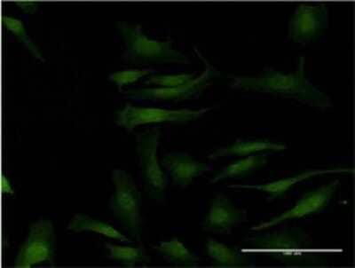 Immunocytochemistry/ Immunofluorescence: MAPKAPK2 Antibody (1F9) [H00009261-M06]