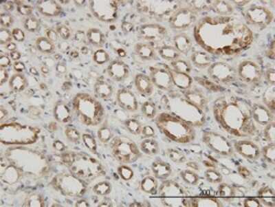 Immunohistochemistry-Paraffin: MAPKAPK2 Antibody (2B3) [H00009261-M01]