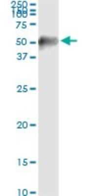 Immunoprecipitation: MAPKAPK2 Antibody (2B3) [H00009261-M01]