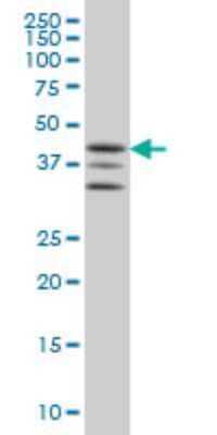 Western Blot: MAPKAPK2 Antibody (2B3) [H00009261-M01]