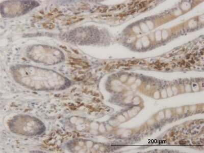 Immunohistochemistry-Paraffin: MAPKAPK2 Antibody (3B8) [H00009261-M08]