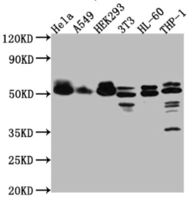 Western Blot: MAPKAPK2 Antibody (4G7) [NBP3-15172]