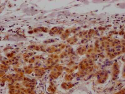 Immunohistochemistry: MAPKAPK2 Antibody (4H8) [NBP3-15173]