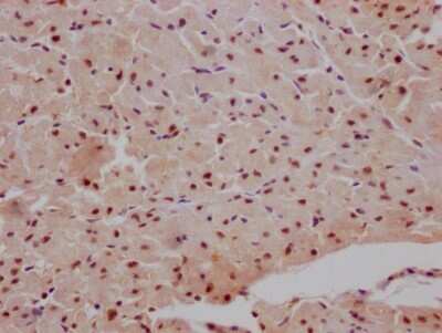Immunohistochemistry: MAPKAPK2 Antibody (4H8) [NBP3-15173]