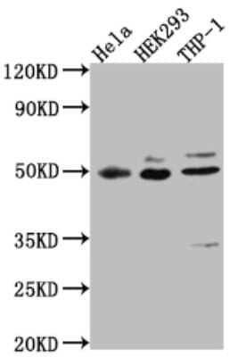 Western Blot: MAPKAPK2 Antibody (4H8) [NBP3-15173]