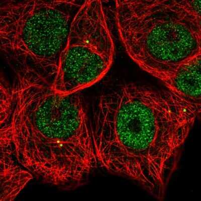 Immunocytochemistry/ Immunofluorescence: MAPKAPK2 Antibody [NBP2-58247]