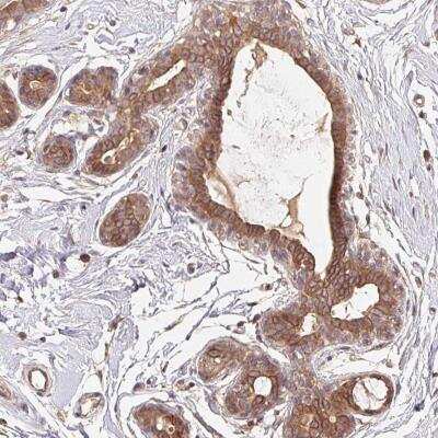 Immunohistochemistry-Paraffin: MAPKAPK2 Antibody [NBP2-56233]