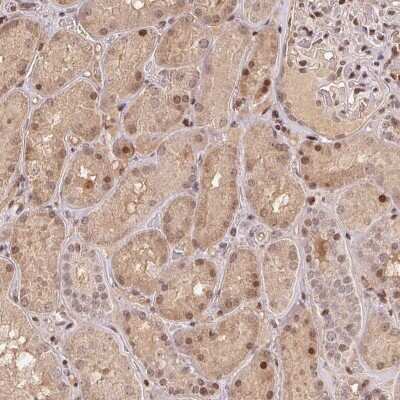 Immunohistochemistry-Paraffin: MAPKAPK2 Antibody [NBP2-57197]