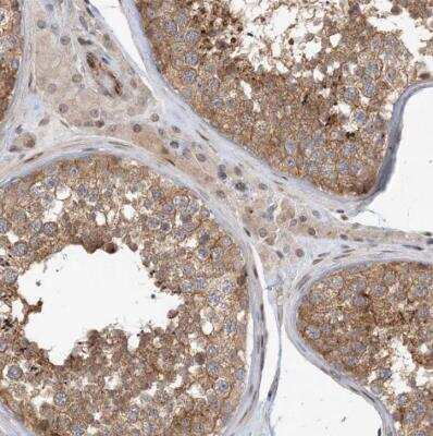 Immunohistochemistry-Paraffin: MAPKBP1 Antibody [NBP1-82984]