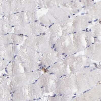 Immunohistochemistry-Paraffin: MAPRE1 Antibody [NBP1-84928]