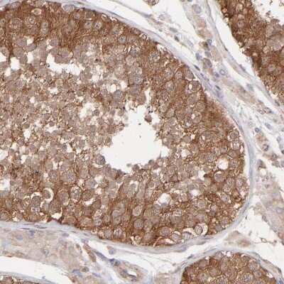 Immunohistochemistry-Paraffin: MAPRE1 Antibody [NBP1-84928]