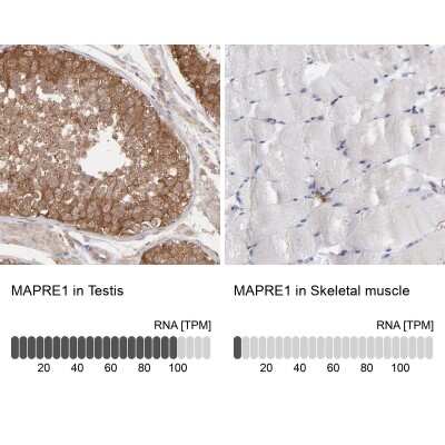 Immunohistochemistry-Paraffin: MAPRE1 Antibody [NBP1-84928]