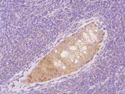 Immunohistochemistry-Paraffin: MAPRE1 Antibody [NBP2-97333]