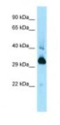 Western Blot: MAPRE1 Antibody [NBP1-98366]