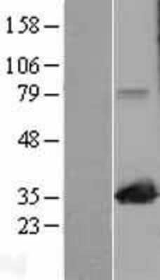 Western Blot: MAPRE1 Overexpression Lysate [NBL1-12891]