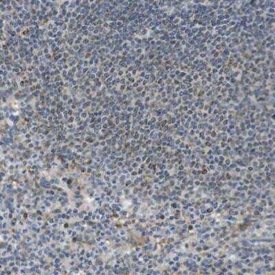 Immunohistochemistry-Paraffin: MARCH1 Antibody [NBP1-91637]