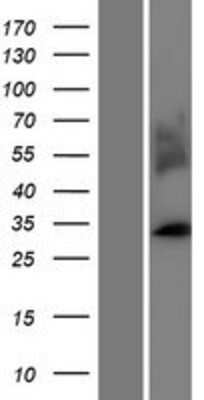 Western Blot: MARCH1 Overexpression Lysate [NBP2-11467]