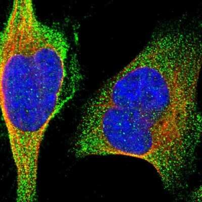 Immunocytochemistry/ Immunofluorescence: MARCH10 Antibody [NBP1-89833]