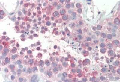 Immunohistochemistry-Paraffin: MARCH10 Antibody [NBP1-28483]