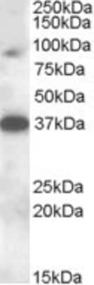 Western Blot: MARCH10 Antibody [NBP1-28483]