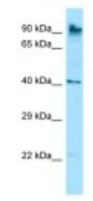 Western Blot: MARCH10 Antibody [NBP1-98327]