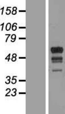 Western Blot: MARCH10 Overexpression Lysate [NBL1-07138]