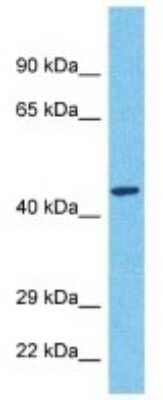 Western Blot: MARCH11 Antibody [NBP3-10571]