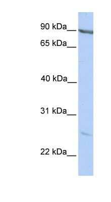 Western Blot: MARCH2 Antibody [NBP1-59391]