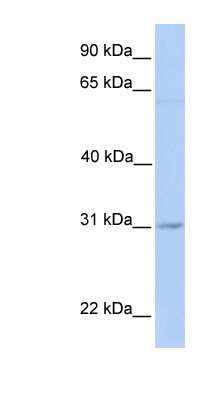 Western Blot: MARCH2 Antibody [NBP1-60051]