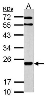 Western Blot: MARCH2 Antibody [NBP2-21582]