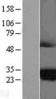 Western Blot: MARCH2 Overexpression Lysate [NBL1-06997]