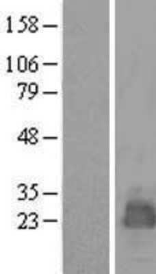 Western Blot: MARCH2 Overexpression Lysate [NBL1-06998]