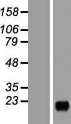 Western Blot: MARCH2 Overexpression Lysate [NBP2-10746]