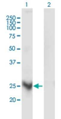 Western Blot: MARCH3 Antibody (1F6) [H00115123-M03]