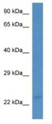 Western Blot: MARCH3 Antibody [NBP1-74194]