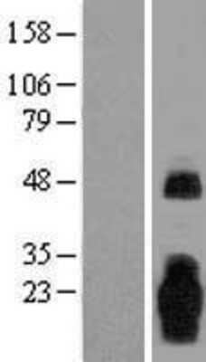 Western Blot: MARCH3 Overexpression Lysate [NBL1-06999]