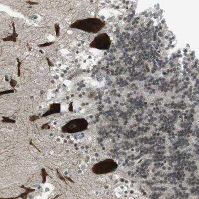 Immunohistochemistry: MARCH4 Antibody [NBP1-91639]